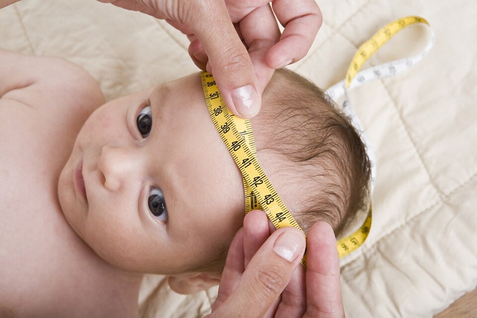 Perimetro Cefalico Quando Devo Me Preocupar Com O Tamanho Da Cabeca Do Bebe